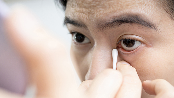 下まぶたのふちを綿棒で確認している様子